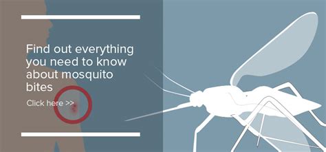 How To Treat Mosquito Bites Debugged