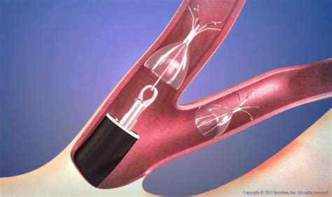 Temple Plays Leading Role In Fda Approval Of A New Minimally Invasive