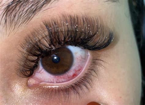 Got My Lashes Done On Saturday Didnt Experience Any Redness Until 6
