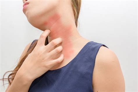 Skin Allergies Allergy And Asthma Specialists