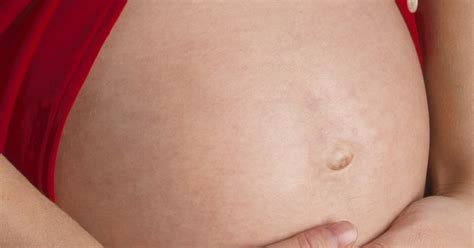 A Bruised Belly Button While Pregnant Livestrongcom