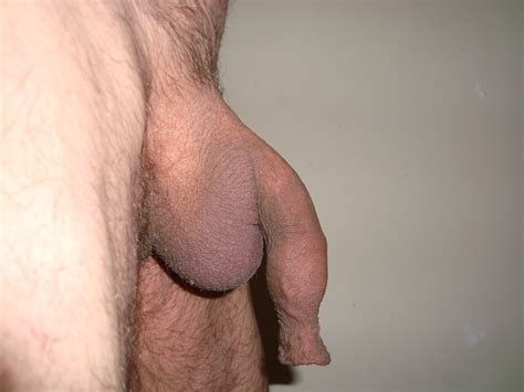 Lf1 In Gallery Long Foreskins Picture 2 Uploaded By