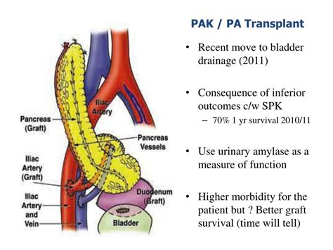 Ppt Kidney Pancreas And Intestinal Transplantation Powerpoint