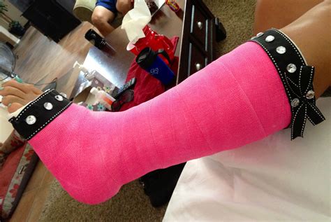 My new bling pink cast. Decorated leg cast. | Leg cast, Cast decoration, It cast
