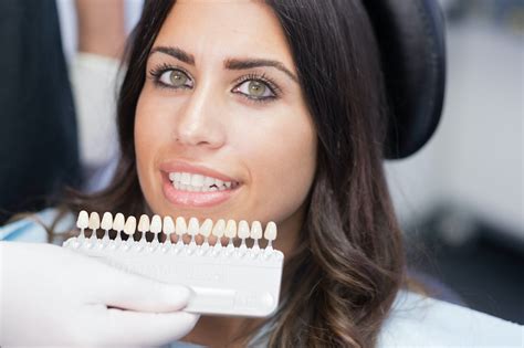 Make Your Smile Shine How Veneers Can Improve Your Smile Coogee