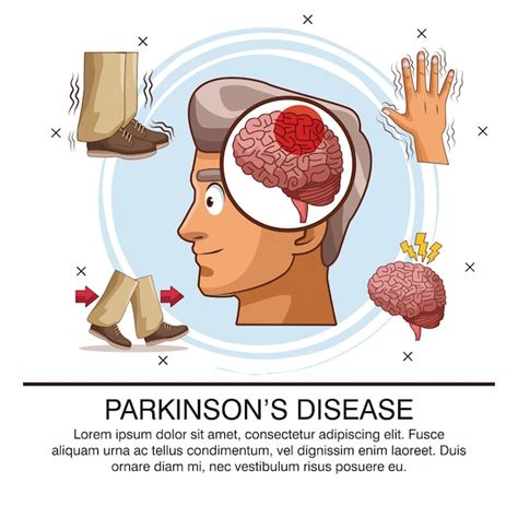 Enfermedad De Parkinson Infografía Vector Premium