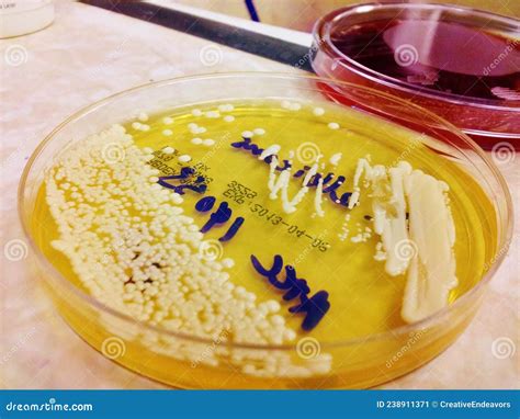White Bacterial Colonies Growing On Yellow Agar Stock Image Image Of