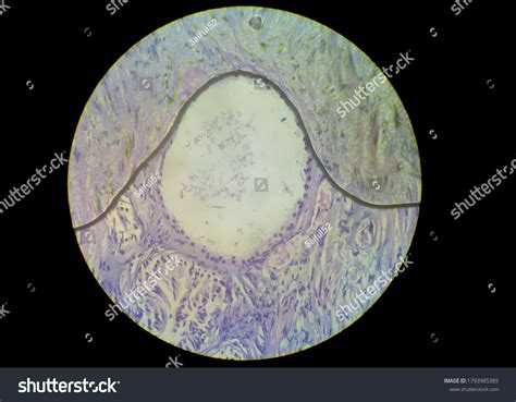 Microscopic View Histology Stained Slide Closeup Stock Photo Edit Now