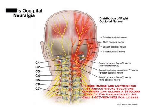 86 Best Occipital Neuralgia Images On Pinterest Occipital Neuralgia