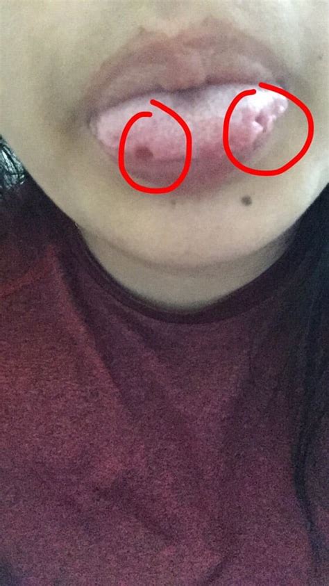It should not be performed and it is incredibly risky and damaging to ones health. This is my crooked snake eyes piercing. Never healed ...