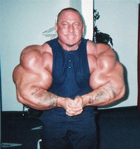 Injecting Synthol Into Your Muscles Can Make You Instantly Look Like A