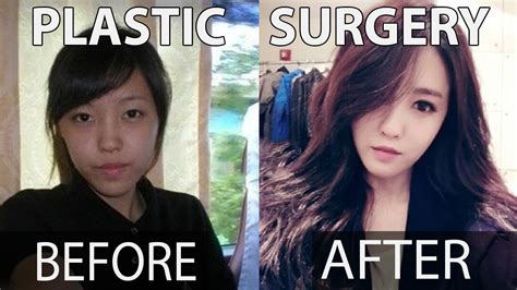 10 Kpop Stars Before And After Plastic Surgery Misup Youtube