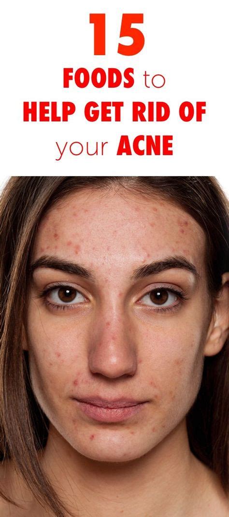 15 Foods To Help Get Rid Of Your Acne Acne Rid Health And Beauty