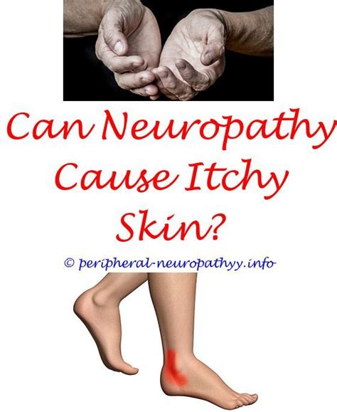Icd 10 Code For Hereditary And Idiopathic Peripheral Neuropathy