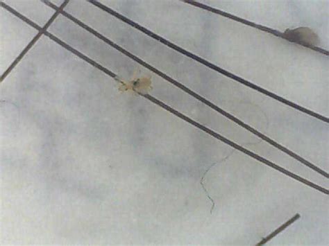 しらみ（頭ジラミ）は 毛穴（頭皮）にもぐる のか？ - しらみ櫛 ...