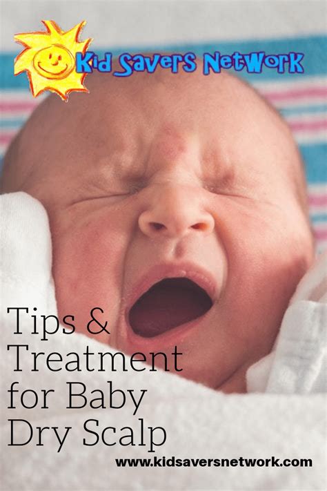 Tips And Treatment For Baby Dry Scalp In Jul 2021 Baby Dry Scalp Baby