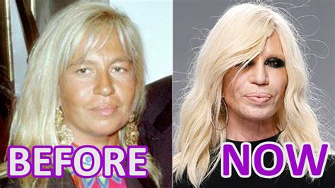 Woman And Time Donatella Versace Before And After Youtube