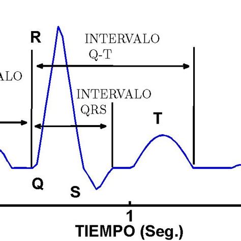Electrocardiograma Normal De La Actividad Eléctrica Del Corazón La