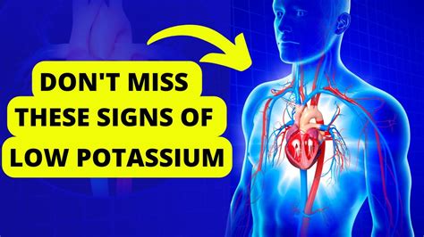 10 signs of low potassium symptoms of potassium deficiency youtube