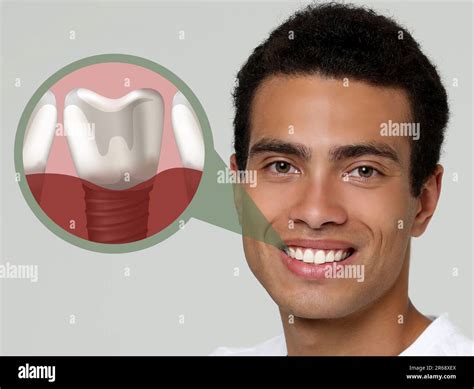 Happy African American Man With Perfect Teeth Smiling On Light Grey