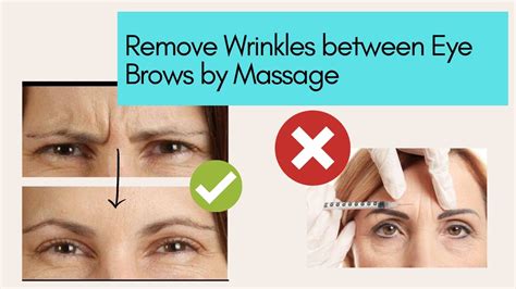 How To Remove Wrinkles Between Eye Brows By Massage Youtube