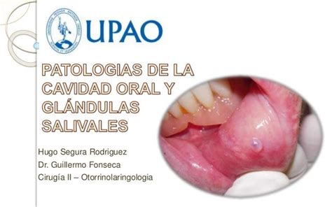 Patología Cavidad Oral Y Glándulas Salivales