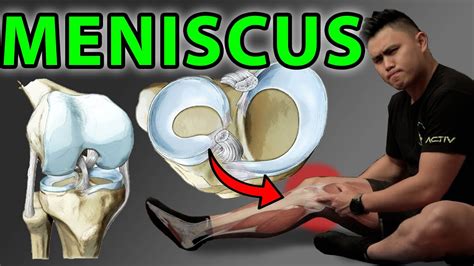 5 Best Meniscus Knee Exercises And Tests For Quick Recovery YouTube