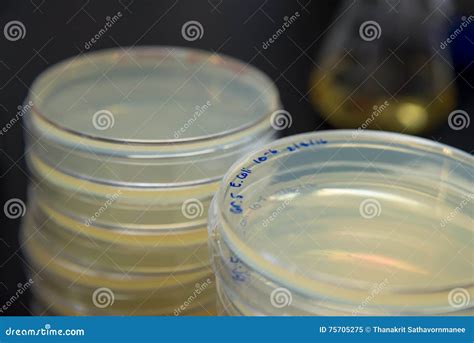 E Coli In Agar Plates Stock Image Image Of Contamination 75705275
