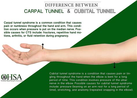 Whats The Difference Between Carpal Tunnel Syndrome And Cubital Tunnel