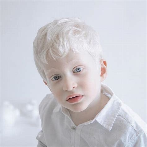 20 Stunning Portraits Showing Albinisms Beauty
