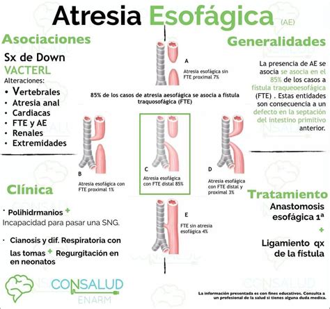 Atresia De Esofago Neonatal