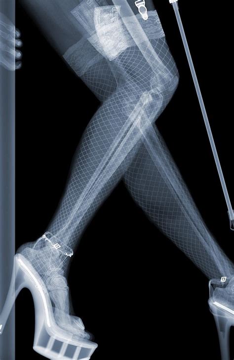 Artist Nick Veasey Exposes What X Rays Can Really See Technology