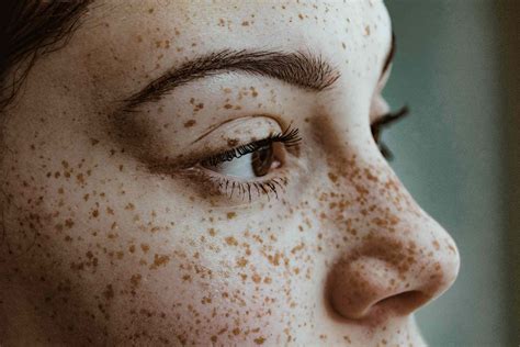 Pimples are in fact one of the most stressful things to spot in morning. How to Prevent and Treat Pimples After a Wax