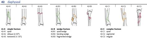 Tibial Plateau Fracture Ao Classification
