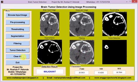 Brain Tumor Detection And Classification Using Image Processing Full