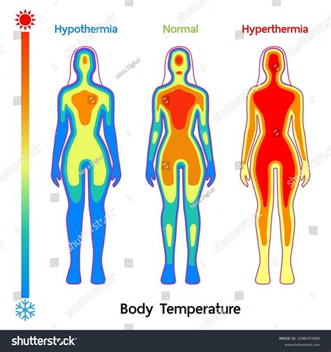 Female Body Temperature Model Normal Hyperthermia Stock Vector Royalty