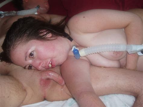 Retard Nude Down Syndrome Retarded Girl Nude