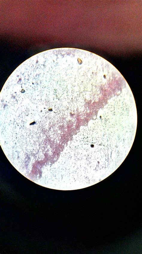 Not long ago, science writer carl zimmer spoke at the zócalo series. E Coli Under Microscope 40x - Micropedia