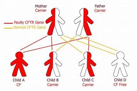 A Female With Cystic Fibrosis Marries A Man Who Is Heterozygous For