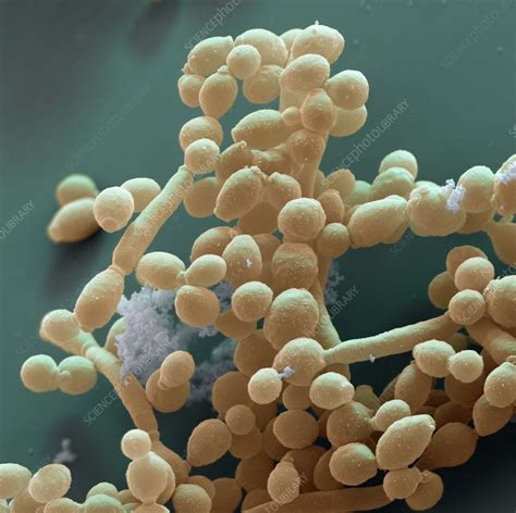 Candida Yeast Cells Sem Stock Image C0090597 Science Photo Library