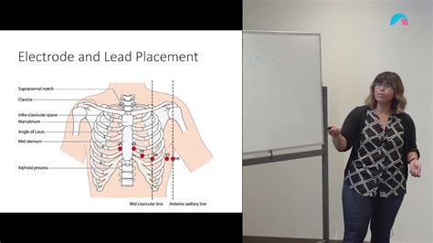 Ekg Leads Placement Diagram Wiring Diagram