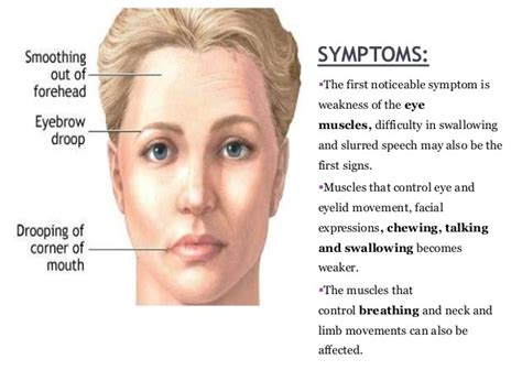 Exposures in nursing pups were ~1% that of maternal exposure on lactation day 10. Myasthenia Gravis MG | Long-Term Neuromuscular Disease ...