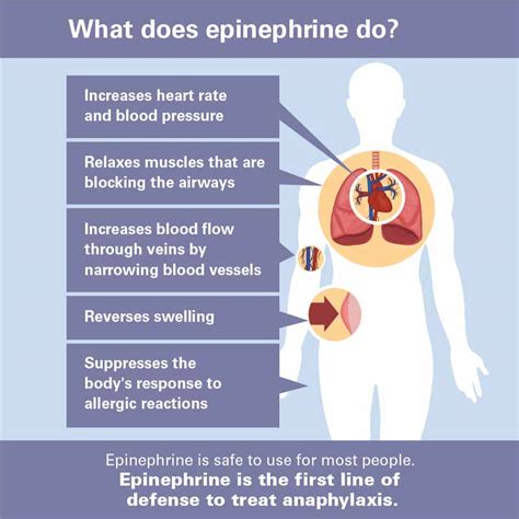 Anaphylaxis Epinephrine Treating A Severe Allergic Reaction