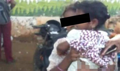4 year old girl forced to sit on hot iron slide by teacher sustains burns on private parts