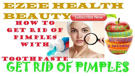 How To Get Rid Of Pimples With Toothpaste Youtube