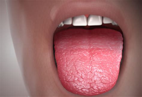 Painful Dry Mouth General Center