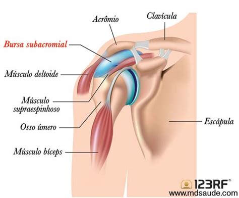 Bursite no ombro Causas Sintomas e Tratamento MD Saúde