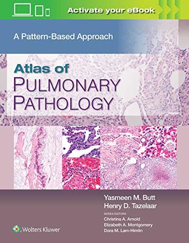 Atlas Of Pulmonary Pathology A Pattern Based Approach Azw3epub