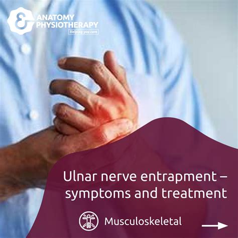 Ulnar Nerve Entrapment Anatomy And Physiotherapy Facebook