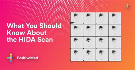 What You Should Know About The Hida Scan Positivemed